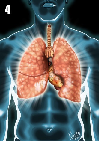 transmutacao-pulmao-p4